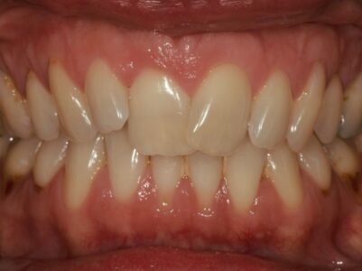 Before - Brunswick Dental Practice