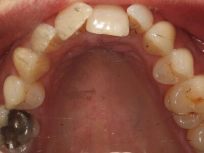 Before Face - Brunswick Dental Practice