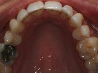 After - Brunswick Dental Practice