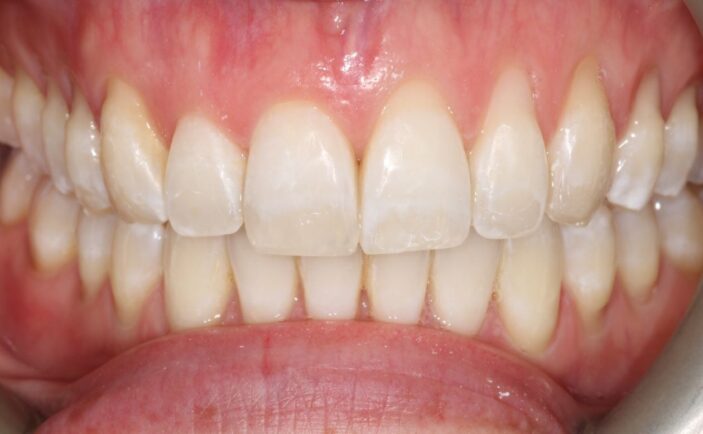 After - Brunswick Dental Practice