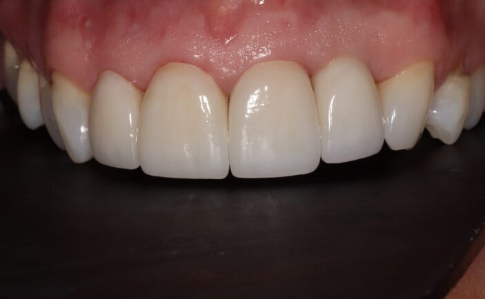 After - Brunswick Dental Practice