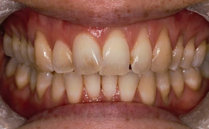 Before - Brunswick Dental Practice