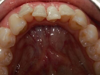 Before Face - Brunswick Dental Practice