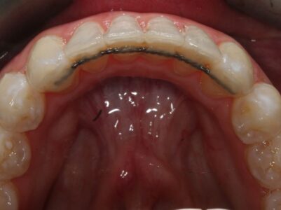 After - Brunswick Dental Practice