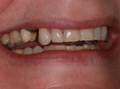 Before - Brunswick Dental Practice