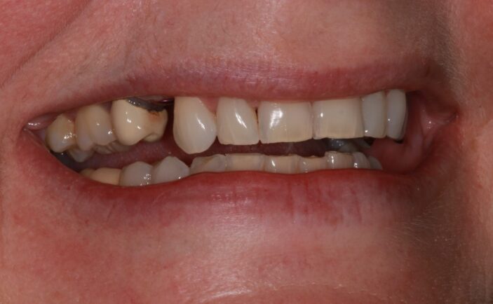 Before - Brunswick Dental Practice