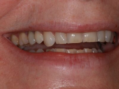 After - Brunswick Dental Practice