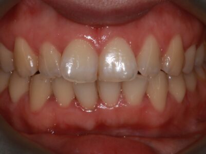 Before - Brunswick Dental Practice