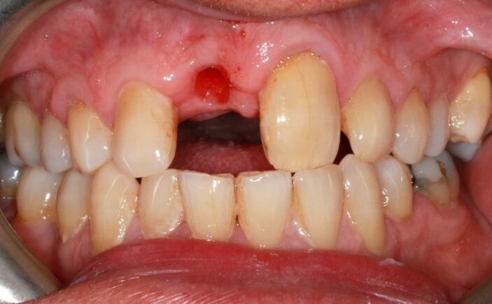 Before - Brunswick Dental Practice