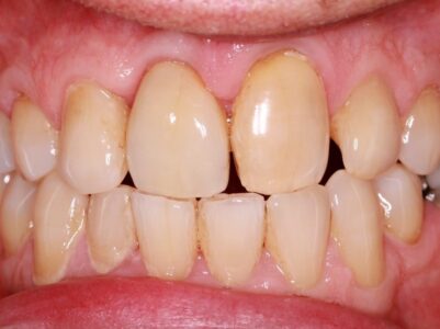 After - Brunswick Dental Practice