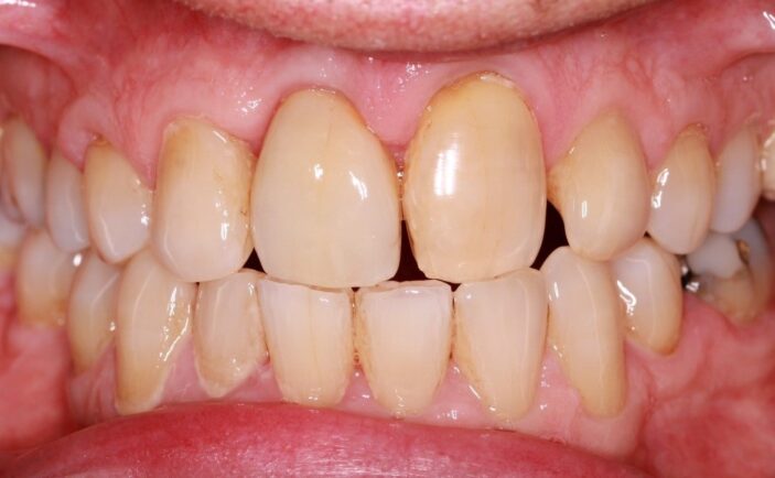 After - Brunswick Dental Practice